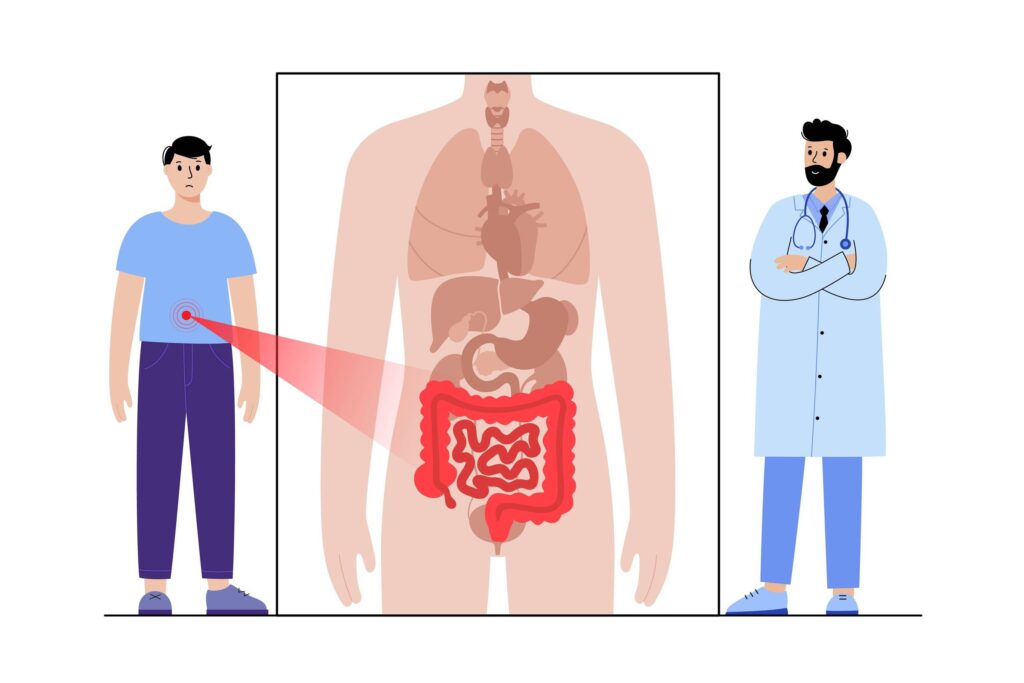 18-respostas-sobre-como-prevenir,-identificar-e-tratar-o-cancer-colorretal